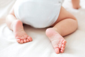 Diaper_rash