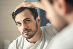 Hair_Loss_in_MEn